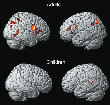 mri brain scan. Brain scan and behavioral